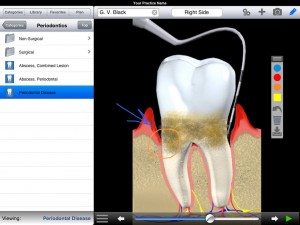 49999-dds-gp-yes-is-an-app-for-dentists-it-helps-professionals-show-patients-specific-treatment-plans-in-a-neat-presentation